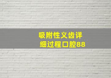 吸附性义齿详细过程口腔88