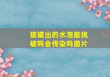 拔罐出的水泡能挑破吗会传染吗图片