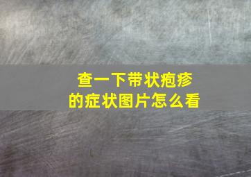 查一下带状疱疹的症状图片怎么看