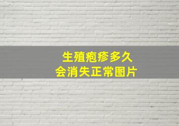 生殖疱疹多久会消失正常图片