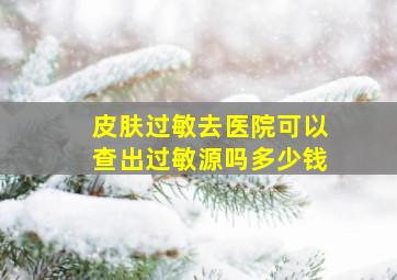 皮肤过敏去医院可以查出过敏源吗多少钱