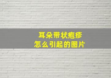 耳朵带状疱疹怎么引起的图片