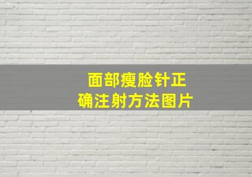 面部瘦脸针正确注射方法图片