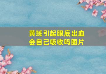 黄斑引起眼底出血会自己吸收吗图片